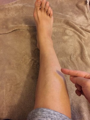 靴下のあと付いてますが気にせずに(-"-)